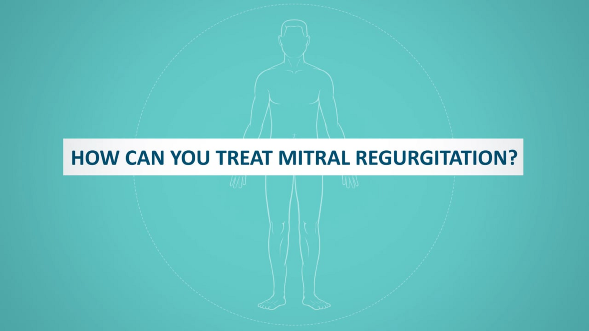 Abbott MitraClip - 3 What are the treatments_NL